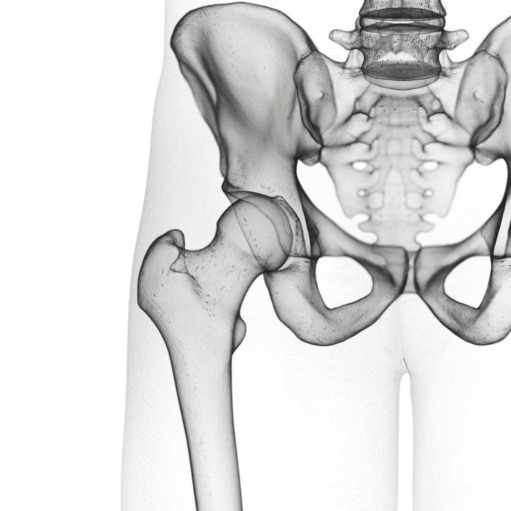 股関節のレントゲン画像
