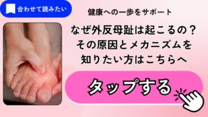 外反母趾のメカニズムのページにリンクします