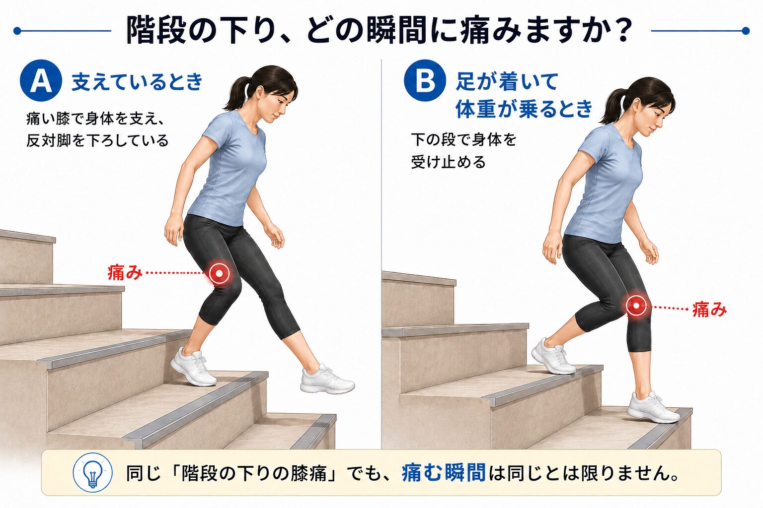 階段を降りる際に膝で身体を支えているときと、足が着いて体重が乗るときの痛みの違い