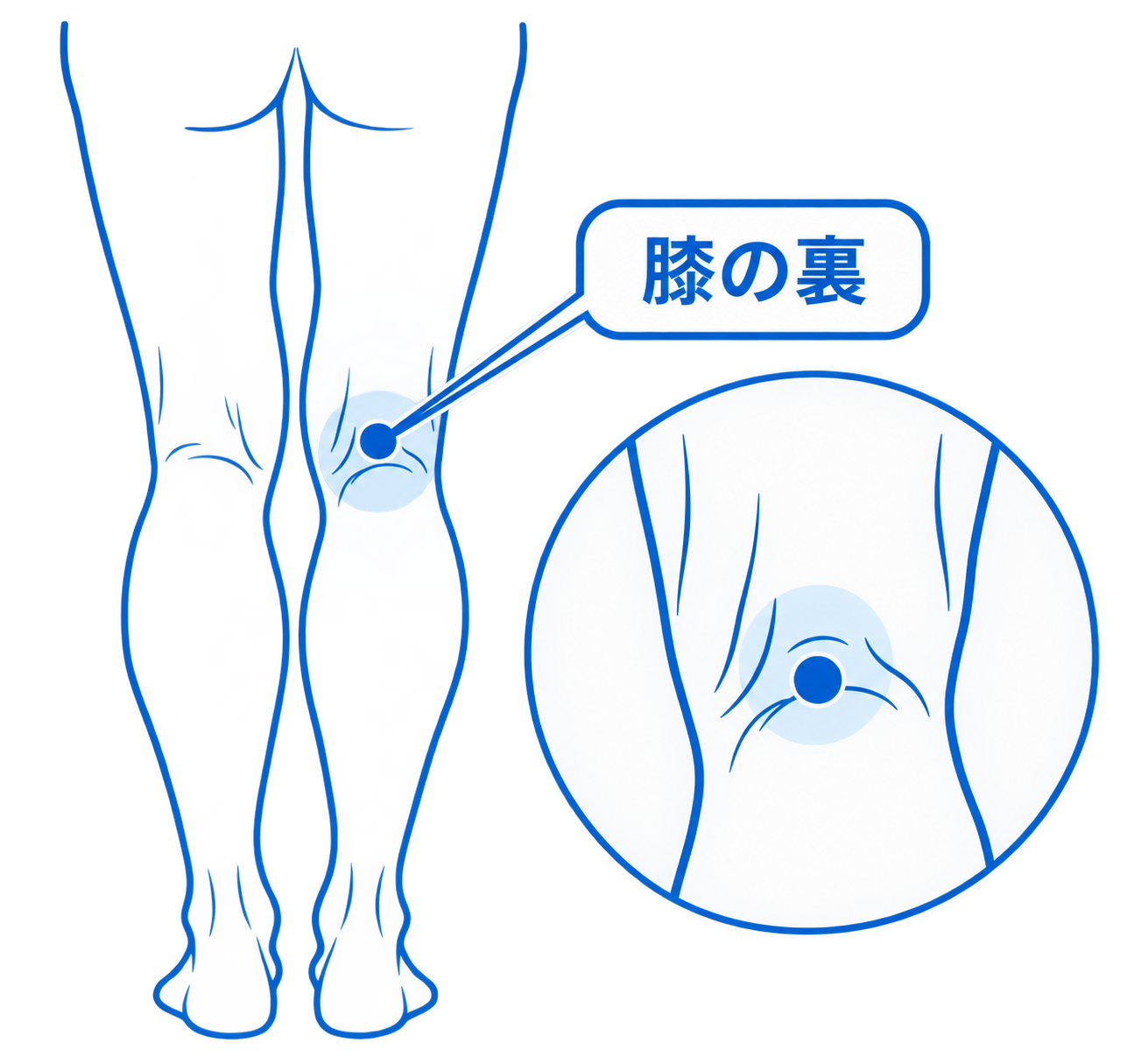 膝の裏の位置